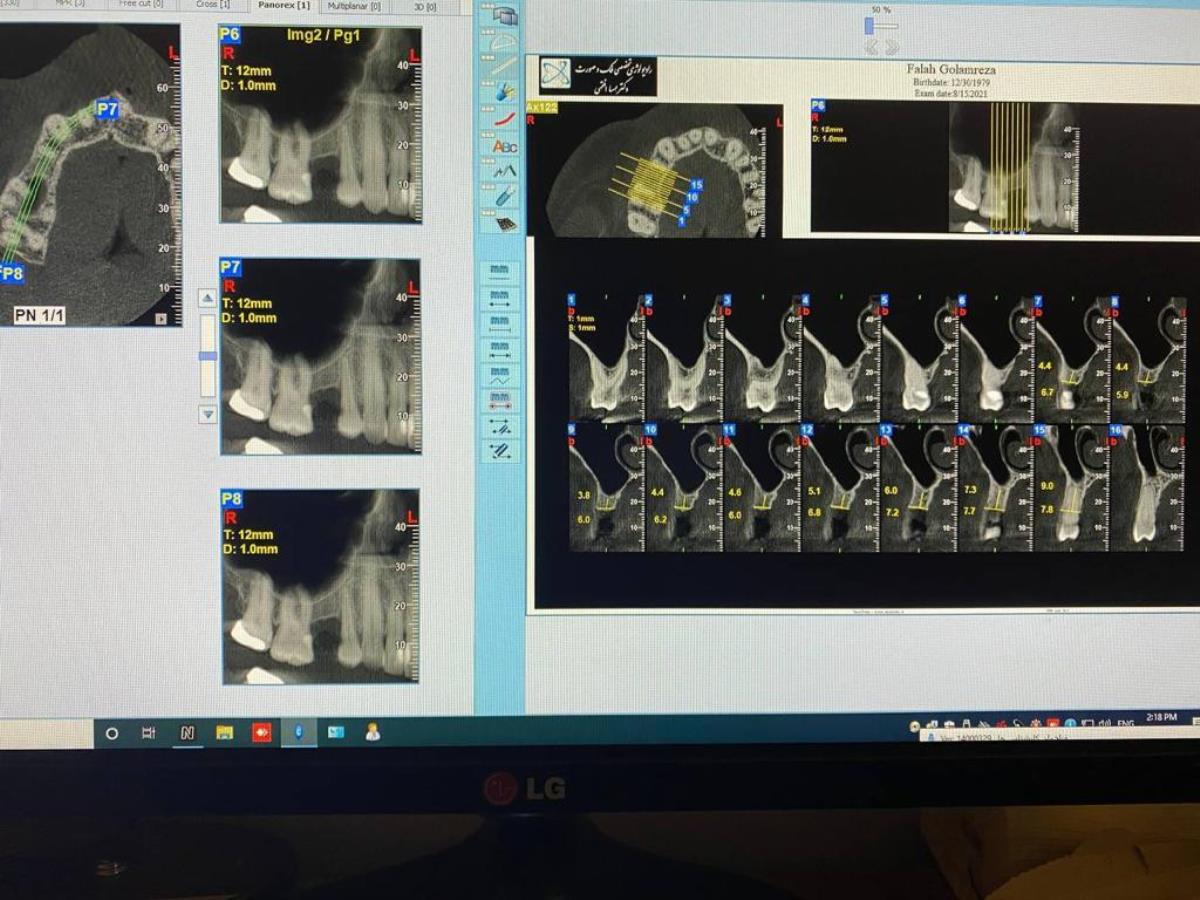 مرکز رادیولوژی دیجیتال تخصصی فک و صورت دکتر افقهی مجهز به دستگاه CBCT  